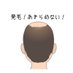 髪増え太＠あきらめないで良かった！
